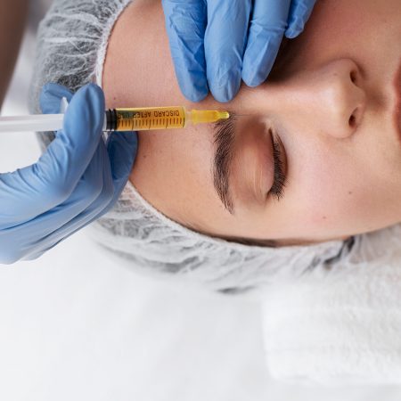 view-woman-getting-face-prp-treatment
